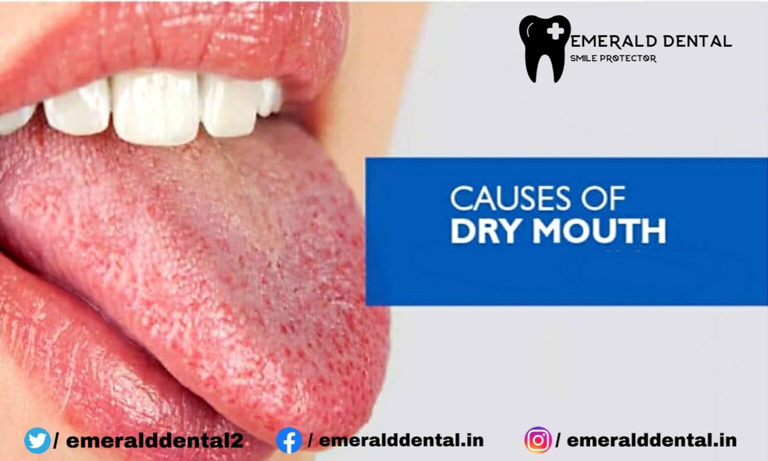 CAUSES OF DRY MOUTH EMERALD DENTAL