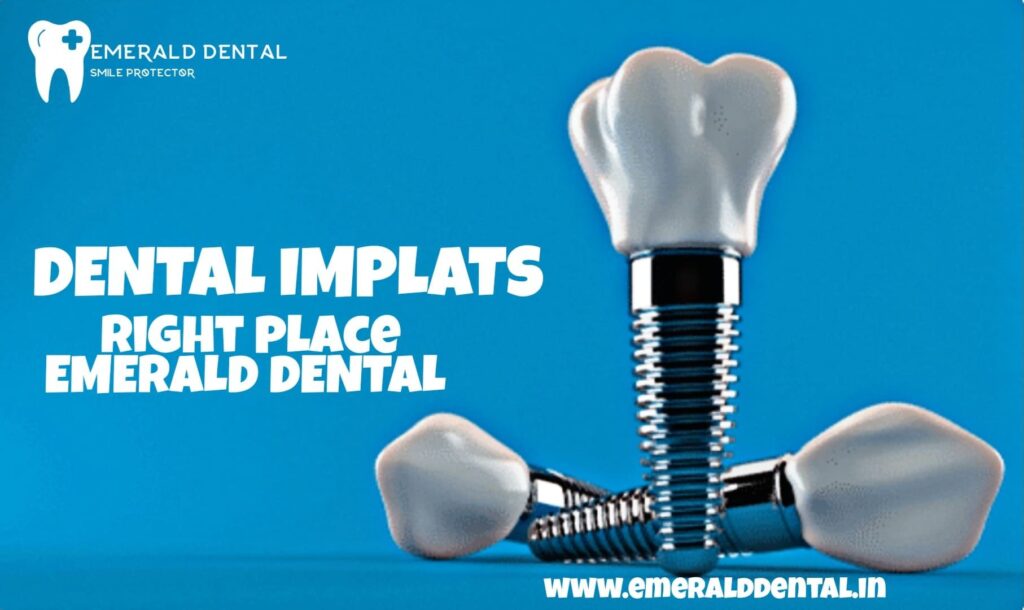 DIFFERENT TYPES OF IMPLANTS